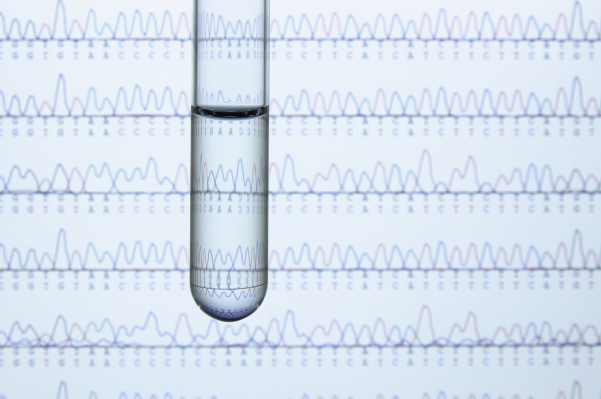 Test tube containing liquid with computer monitor displaying results of automated DNA sequencing Test tube containing liquid with computer monitor displaying results of automated DNA sequencing
